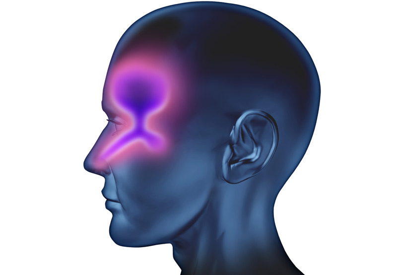 Sinus-Headaches-Dr.-Edward-Kuan